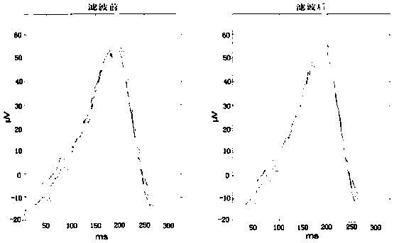 Method for obtaining standard parameter range of adult Chinese rural dog electrocardiogram