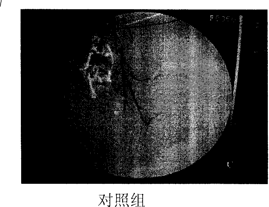 Supersonic microvesicle target positioning controlled-release/gene device and target transferring method