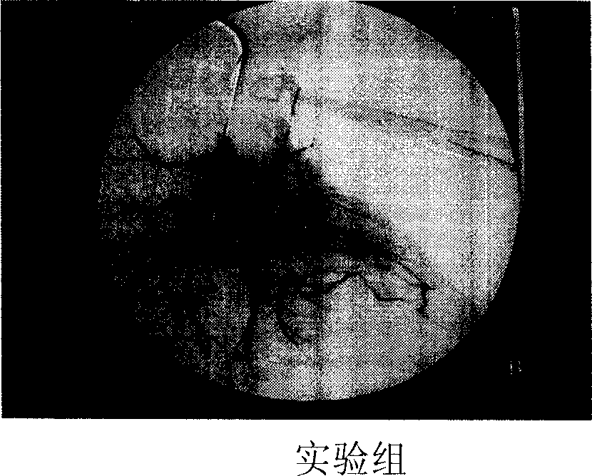 Supersonic microvesicle target positioning controlled-release/gene device and target transferring method