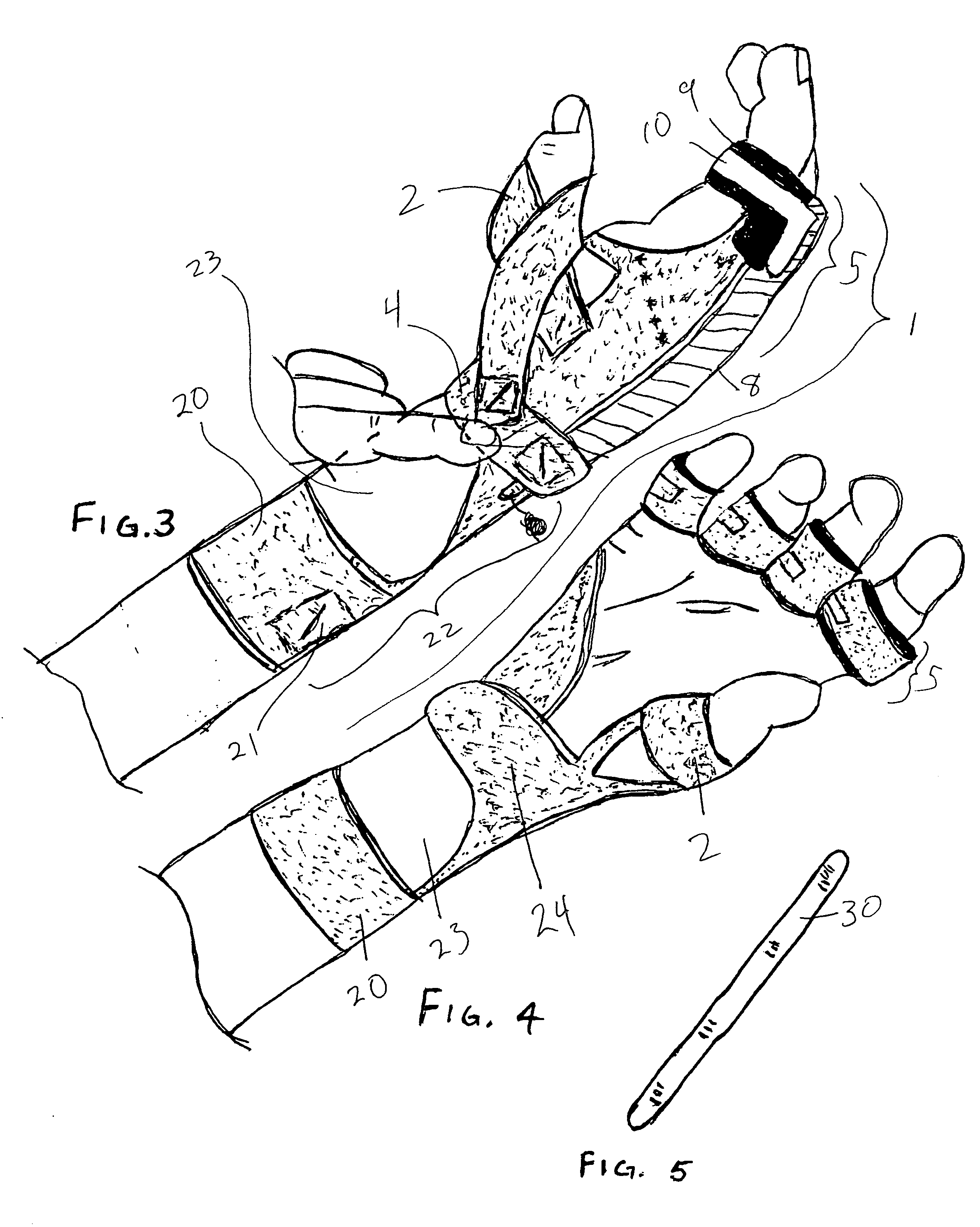 Low-profile, radial nerve splint with interchangeable resilient digit extensor elements and supination adjustment means