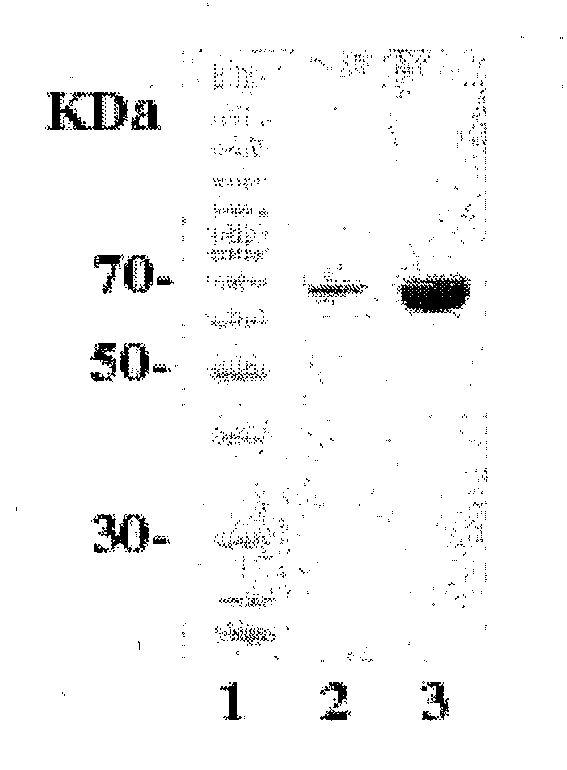 Re-engineered UV damage endonuclease, compositions and methods