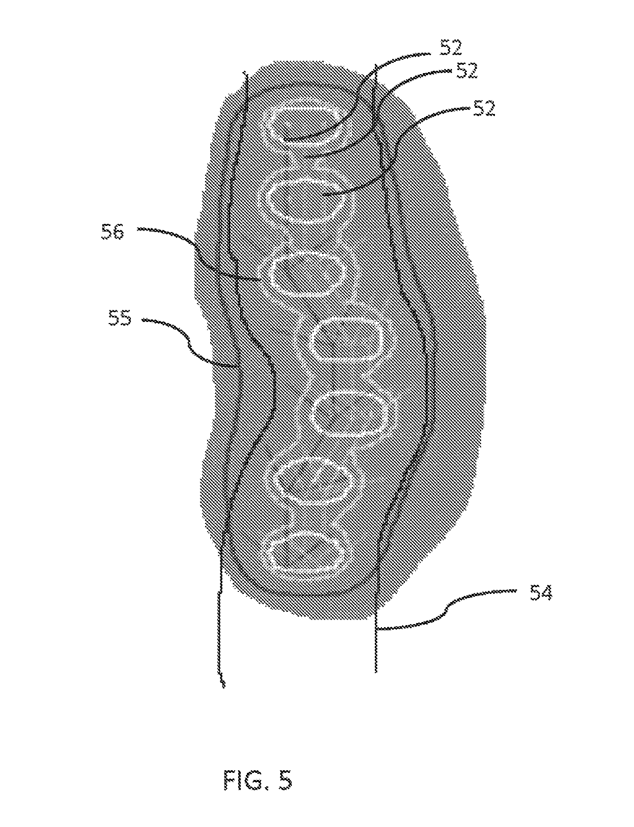 Device and method for improving brachytherapy