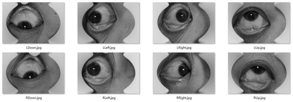 Eye image and symptom information association method