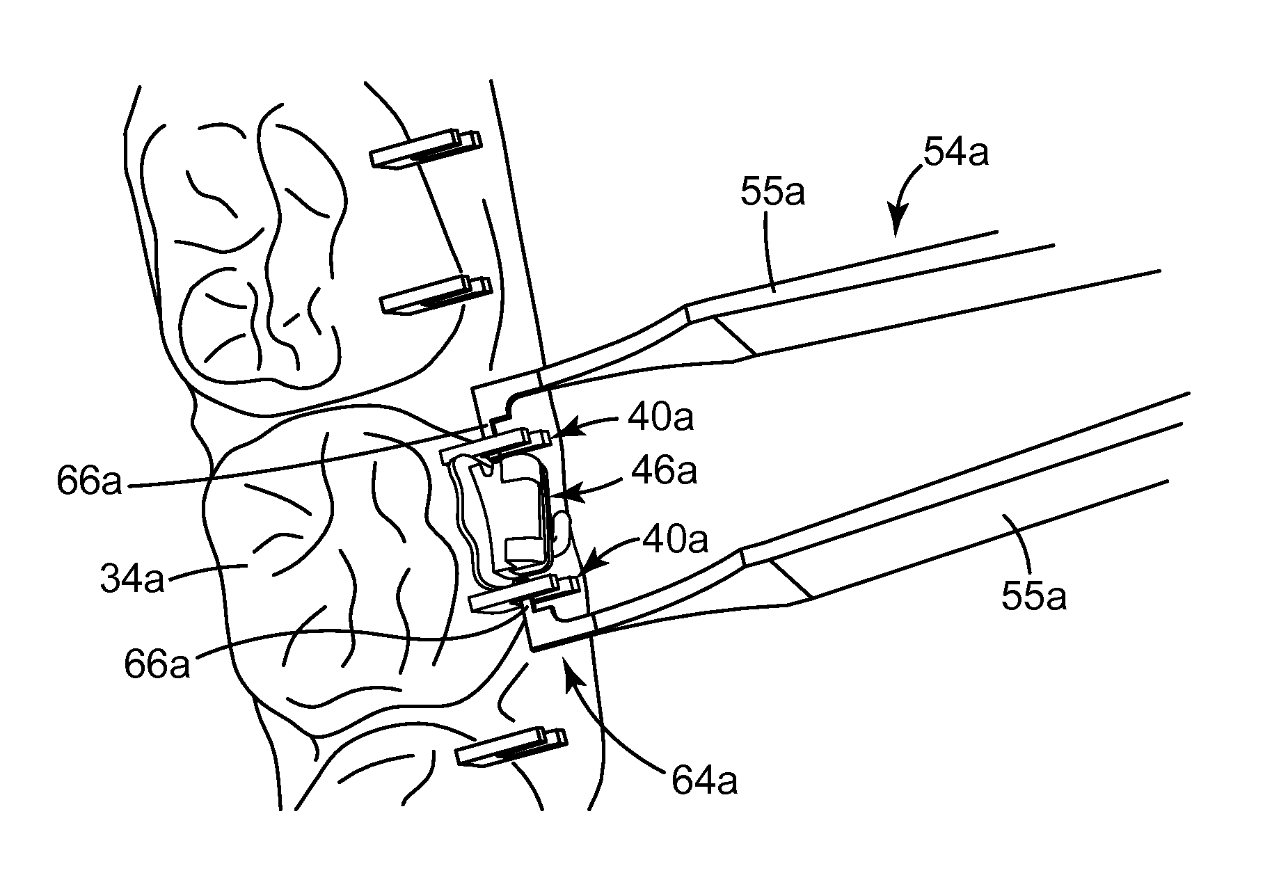 Methods and assemblies for making an orthodontic bonding tray using rapid prototyping