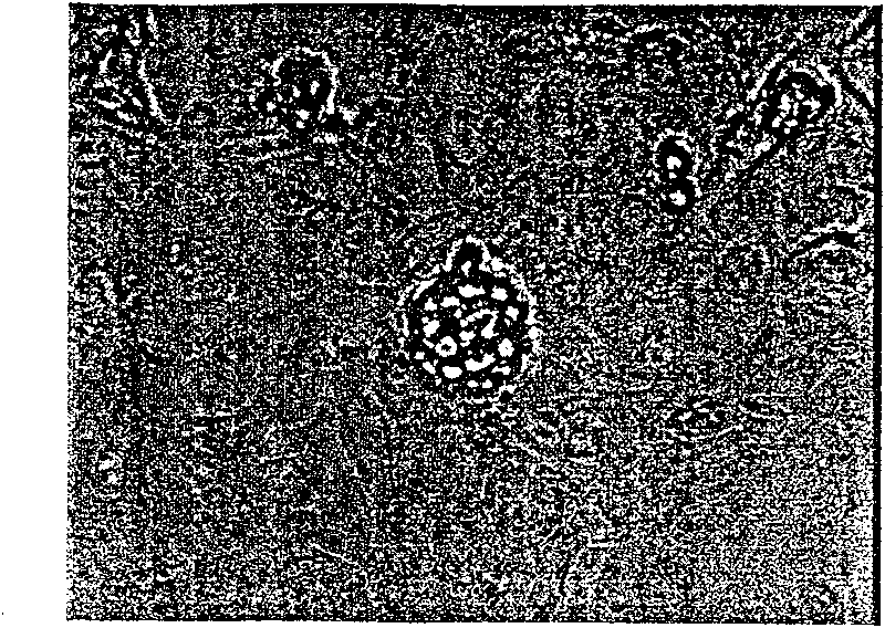 Method of separating derma epidermis stem cell