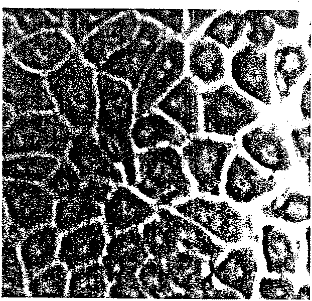 Method of separating derma epidermis stem cell