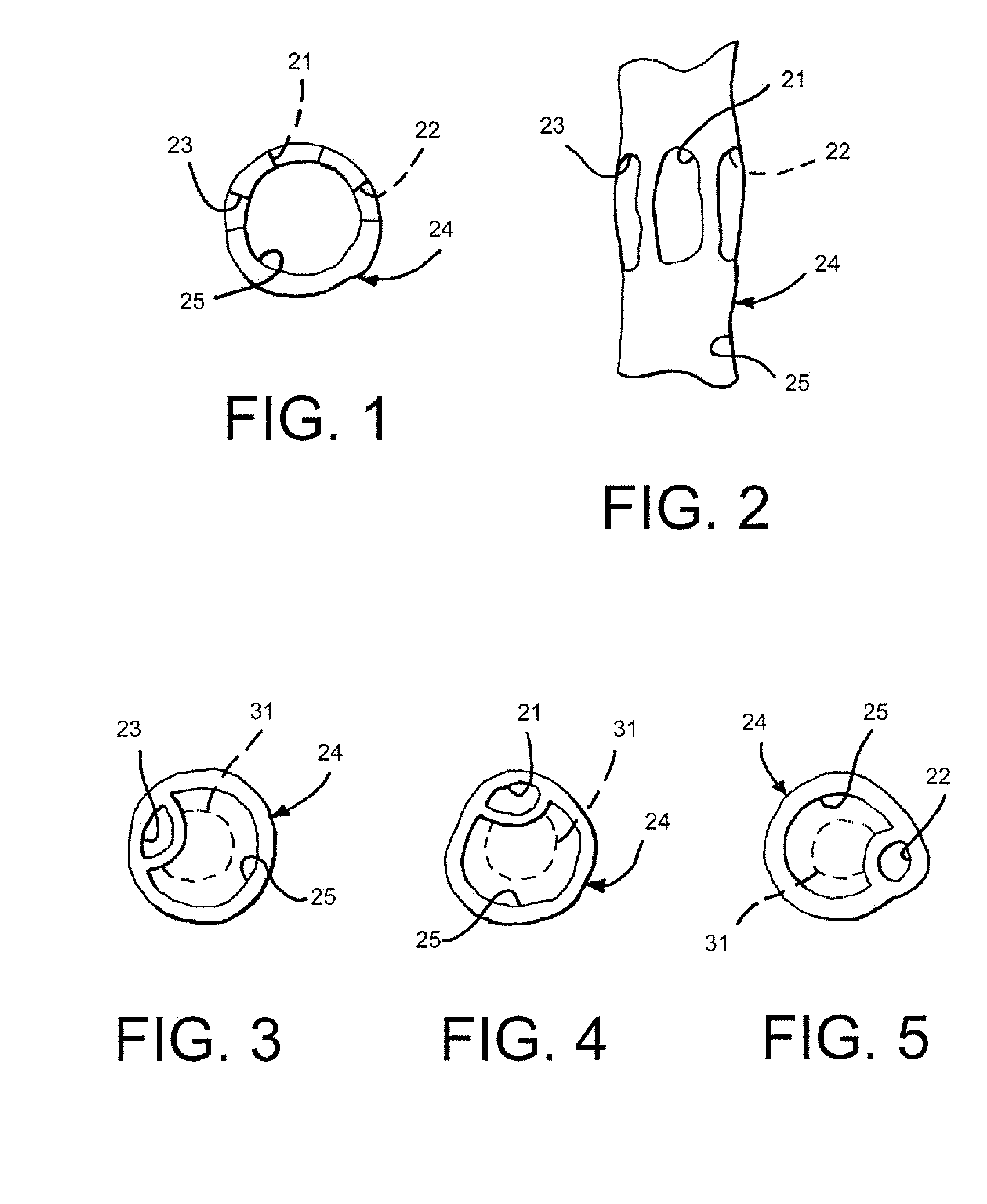 Self-Orientating Suture Wound Closure Device