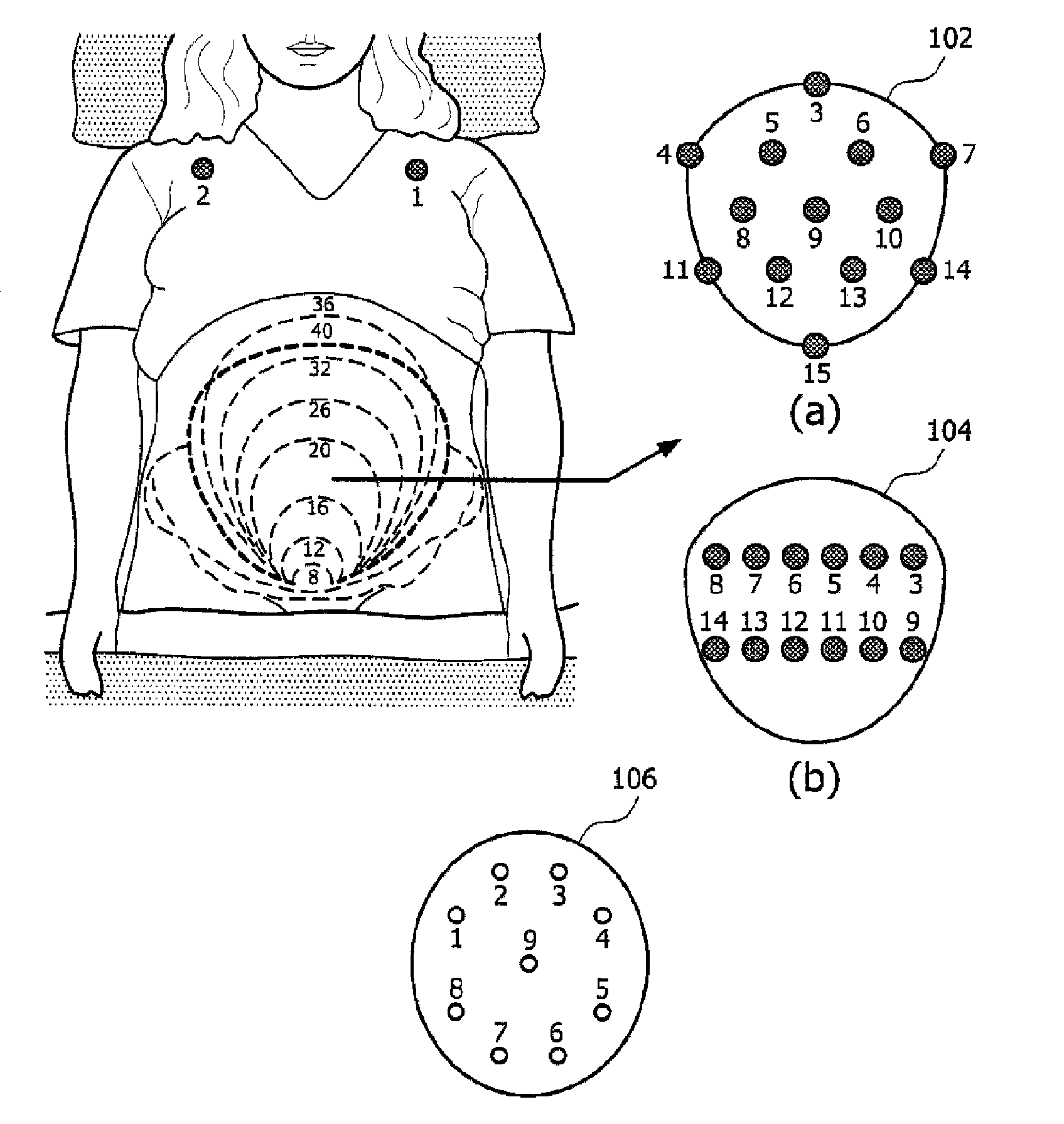 Fetal monitoring