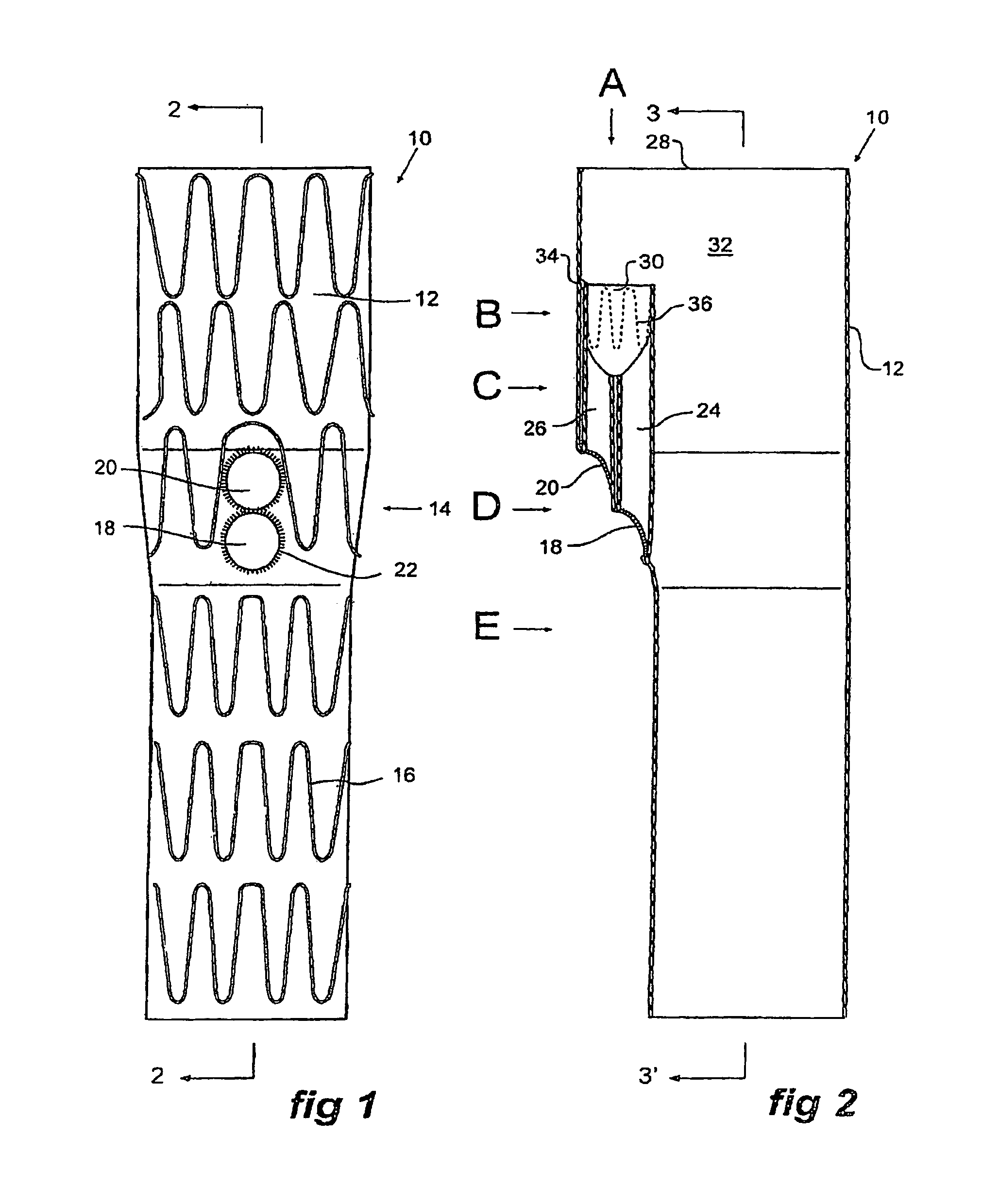 Stent graft