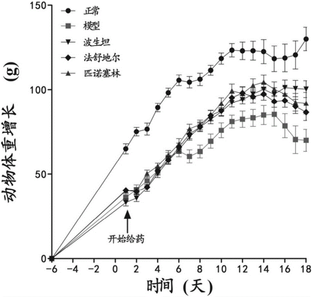 Application of pinocembrin to preparation of medicines for preventing and/or treating pulmonary hypertension