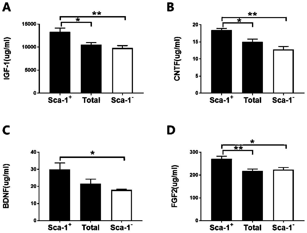 Application of stem cell Sca-1&lt;+&gt; subgroup exosome in preparation of biological agent for repairing retinal injury