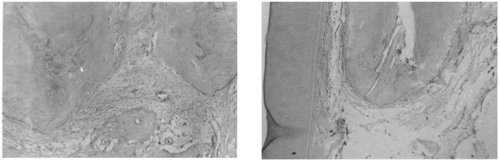 Calcium phosphate composite material for filling root canal and preparation method thereof