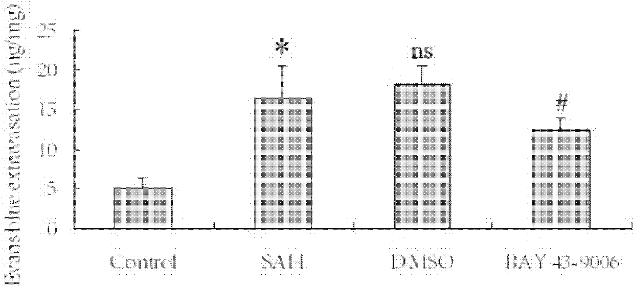 The application of sorafenib in the treatment of early brain injury after subarachnoid hemorrhage