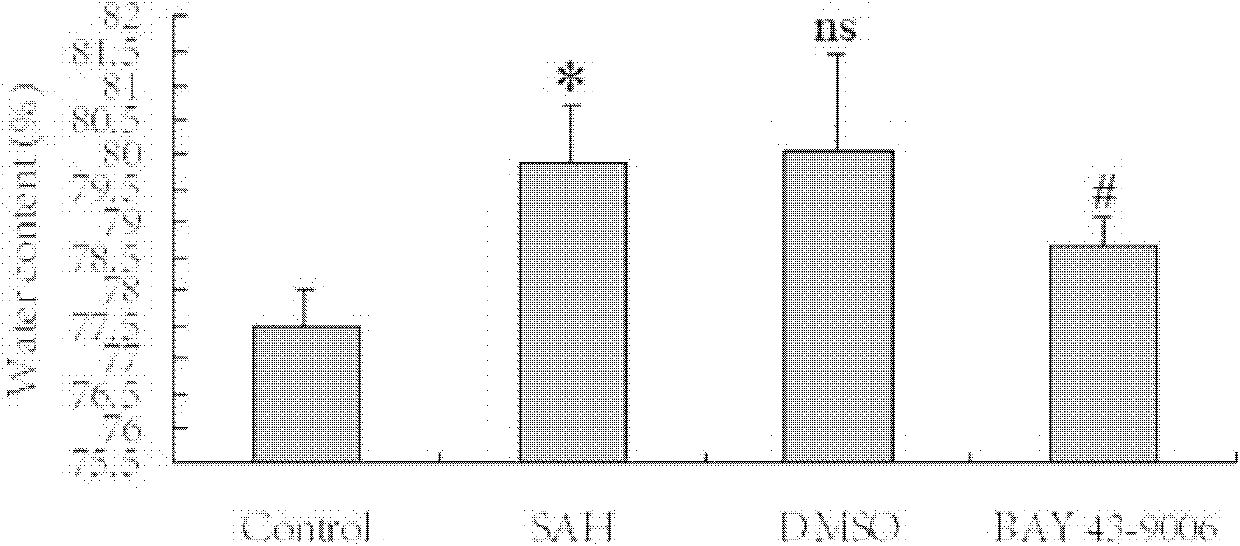 The application of sorafenib in the treatment of early brain injury after subarachnoid hemorrhage