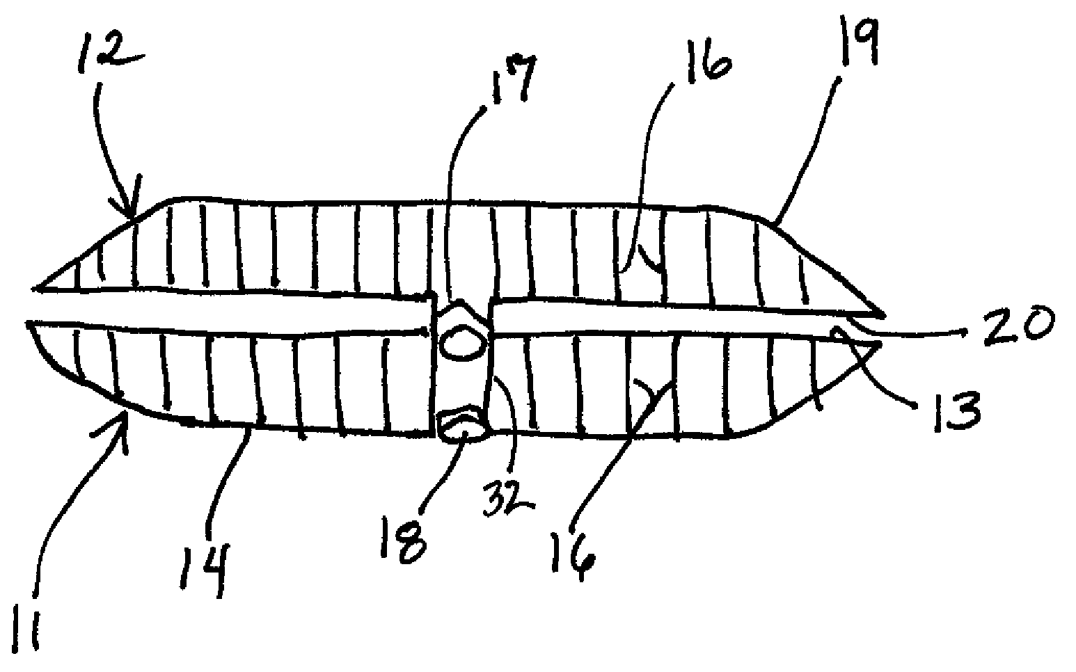 Aneurysm sealing device