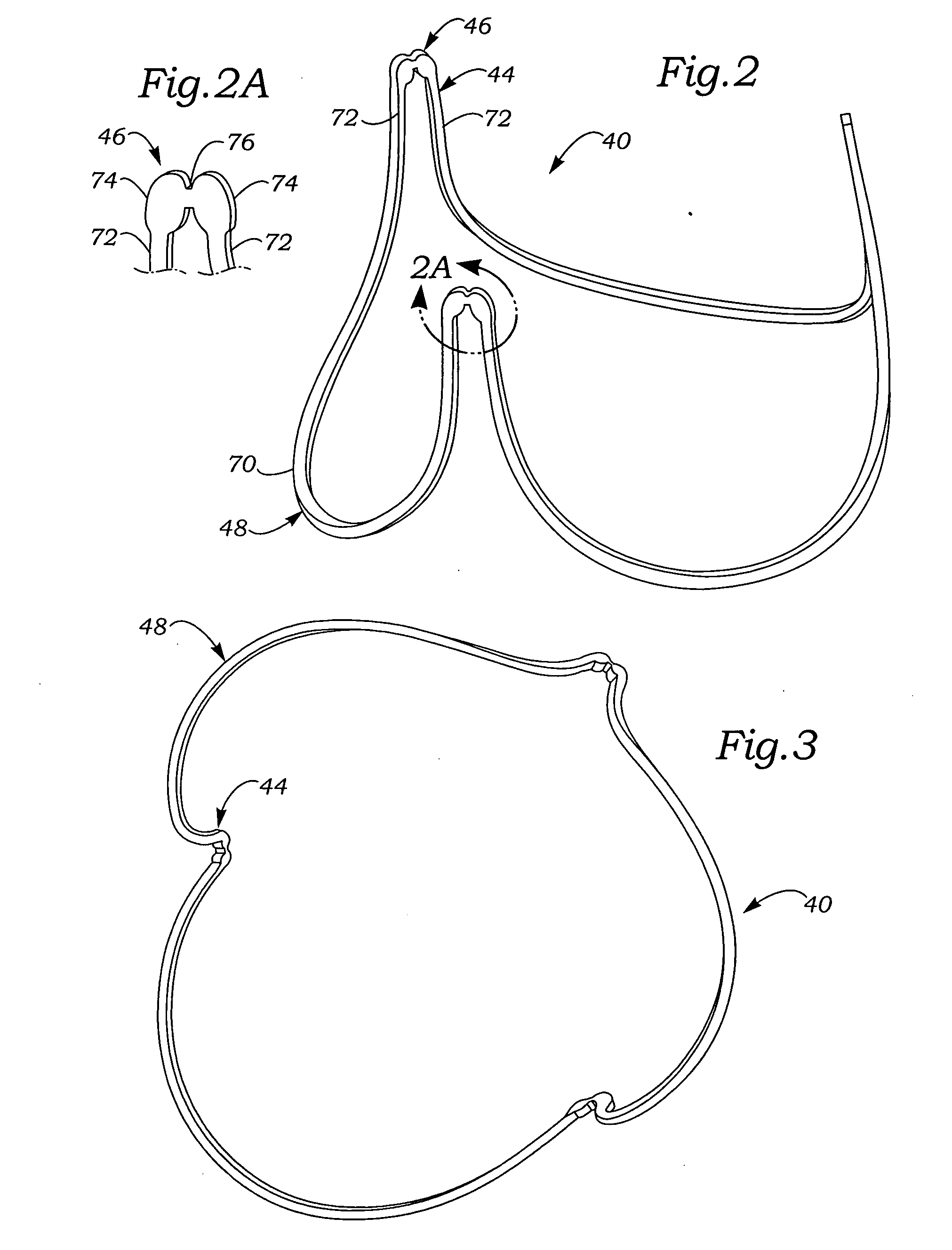 Controlled separation heart valve frame