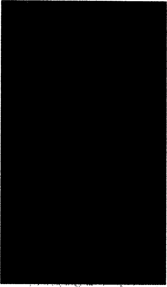 Application of agglutinin II protein of rhizome of manyflower solmonaeal in pharmacy