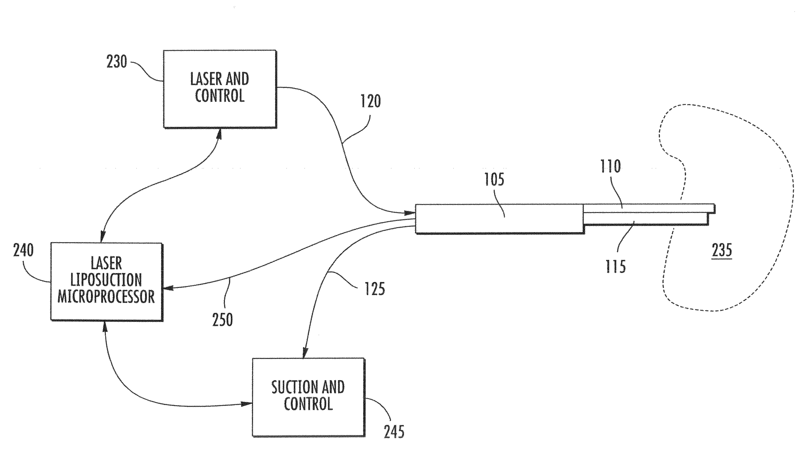 Coaxial suction system for laser lipolysis