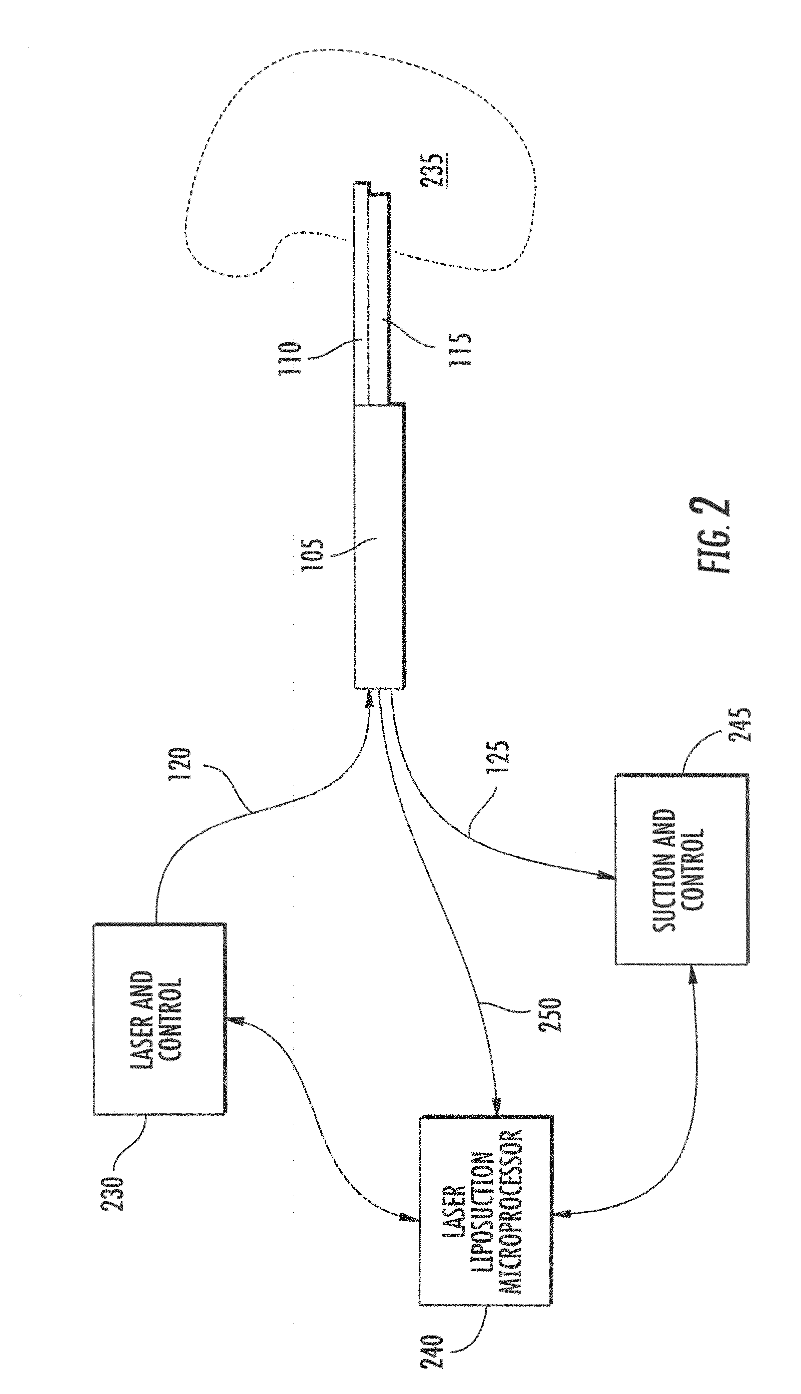 Coaxial suction system for laser lipolysis