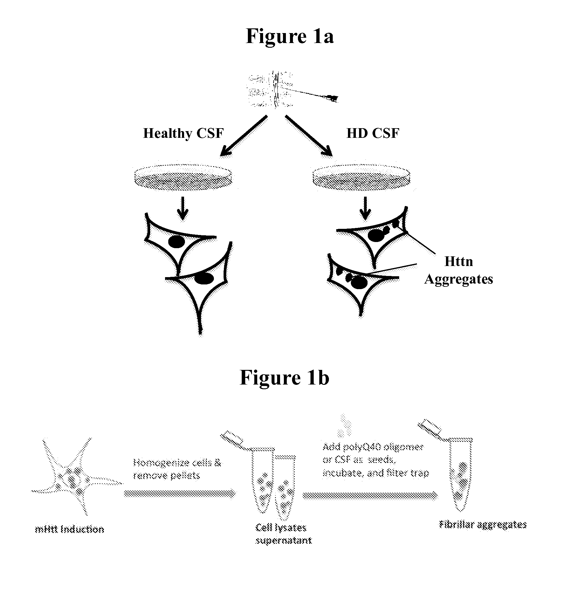 Diagnostic and monitoring system for huntington's disease