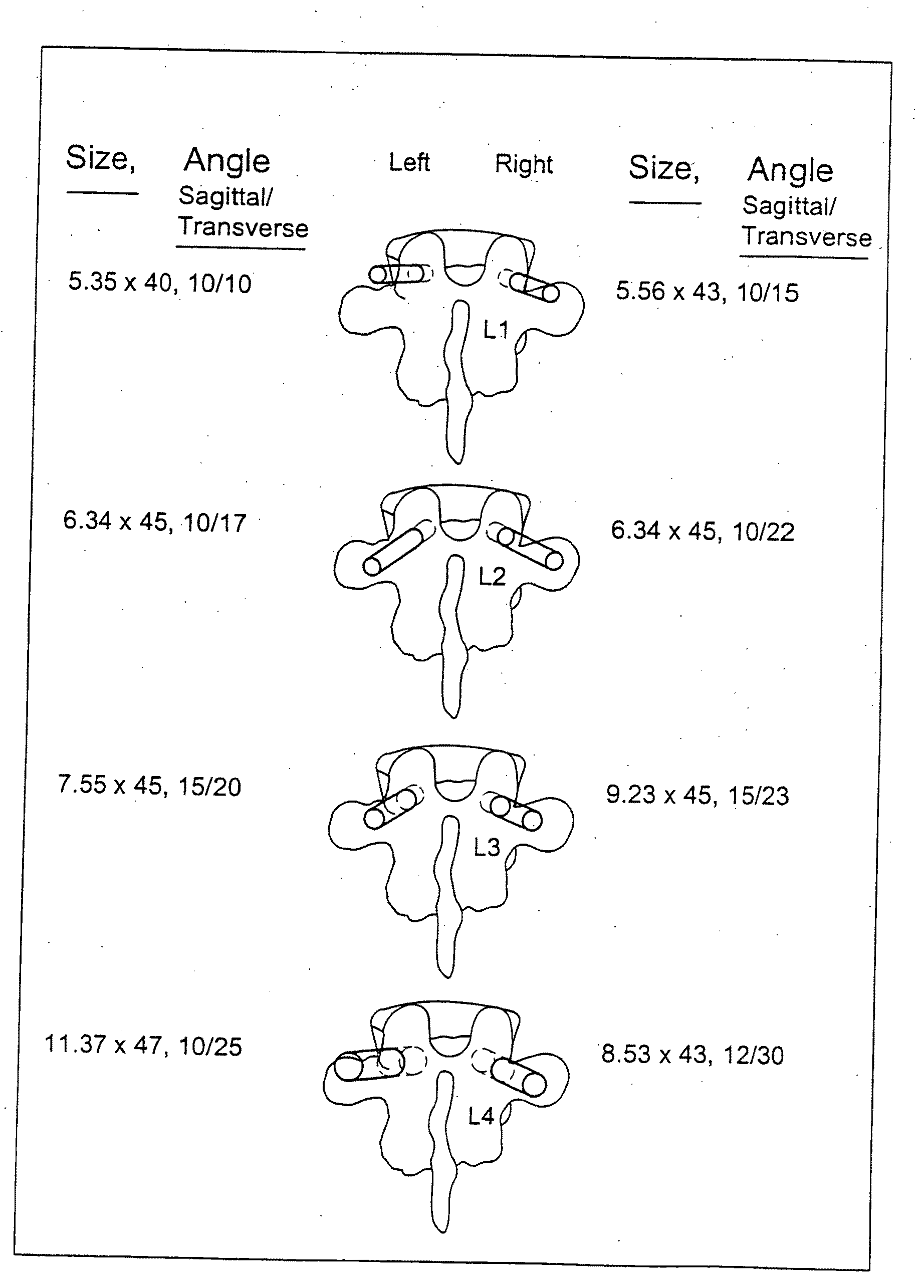 System and methods for improved access to vertebral bodies for kyphoplasty, vertebroplasty, vertebral body biopsy or screw placement