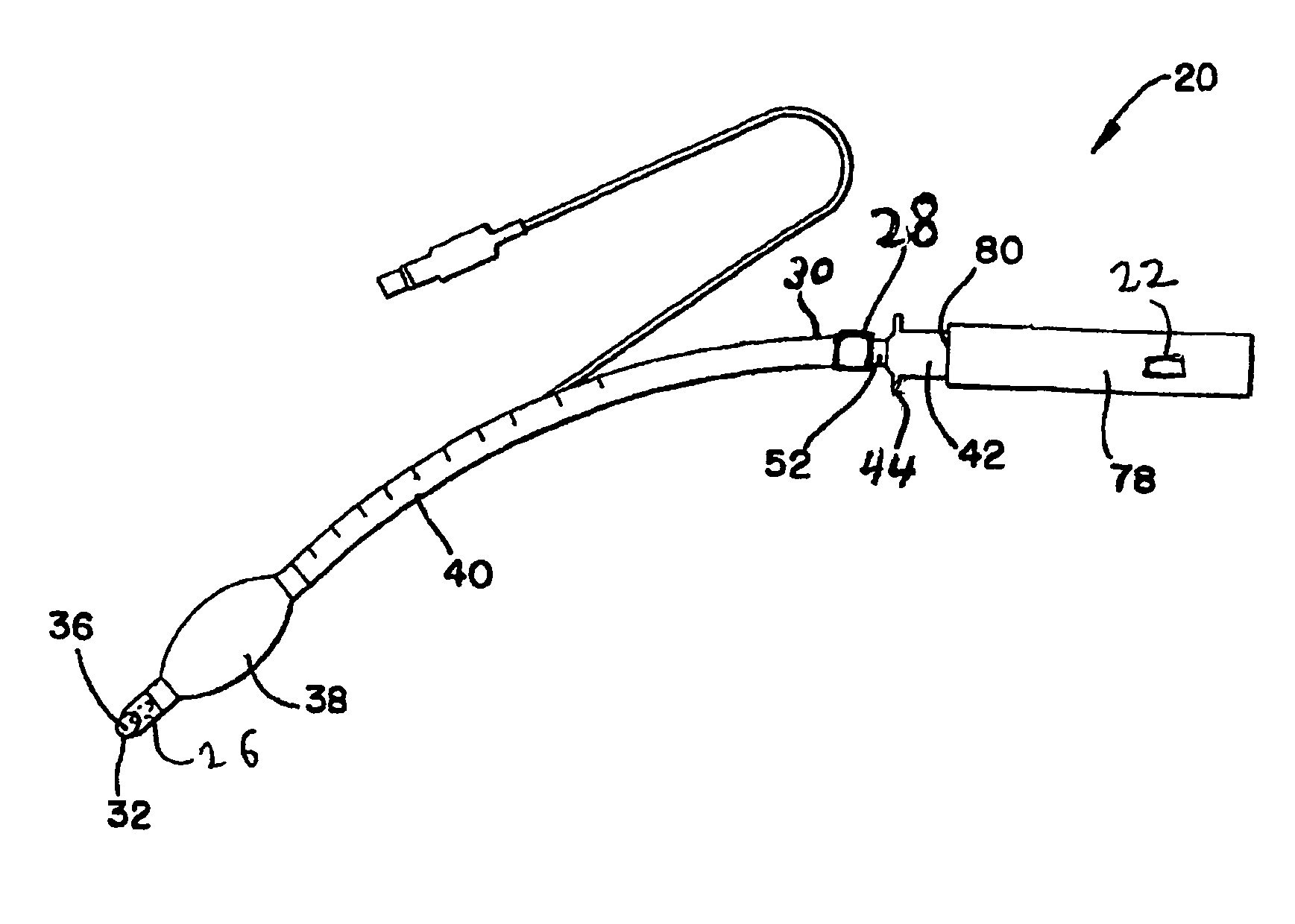 System and method for managing difficult airways