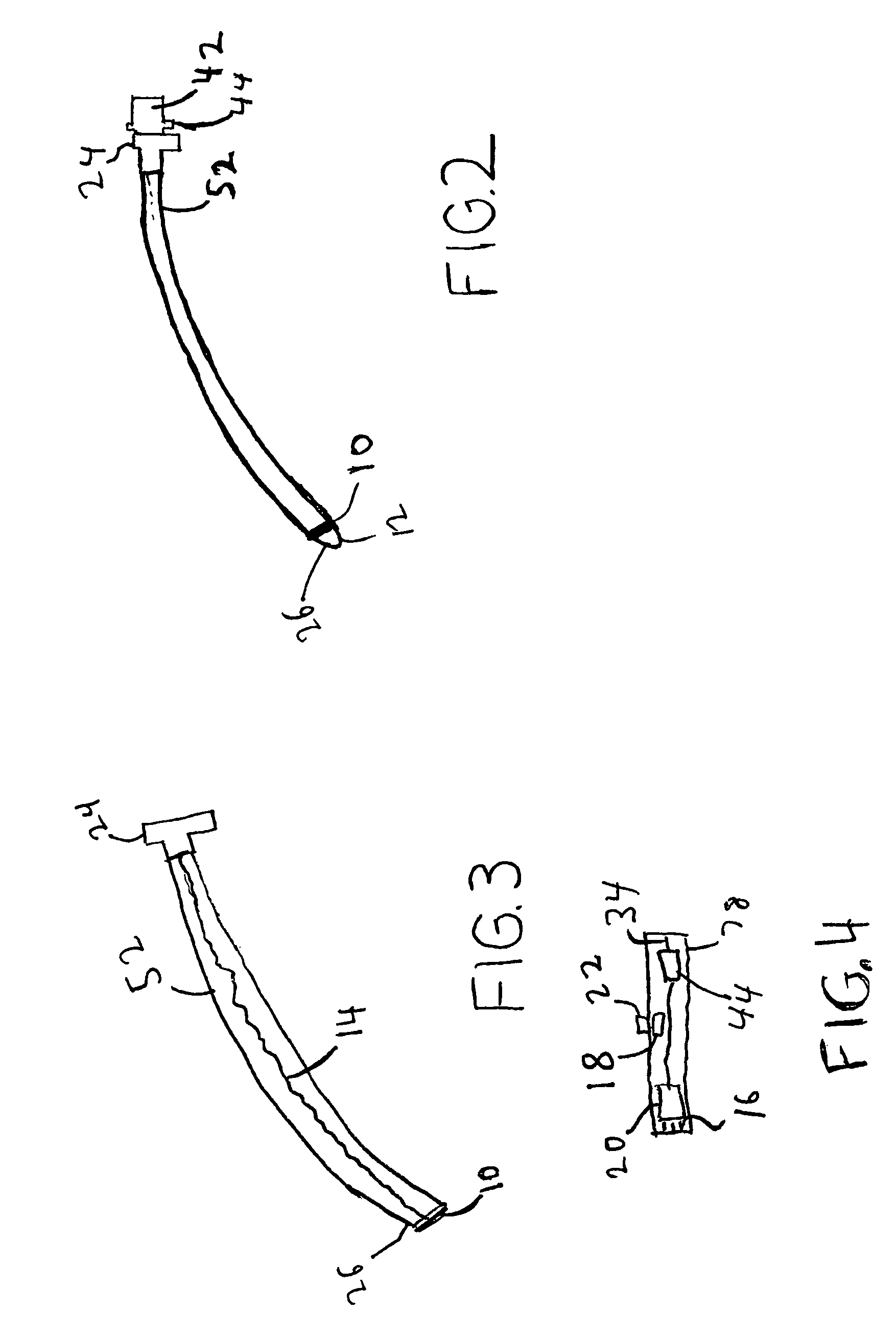 System and method for managing difficult airways