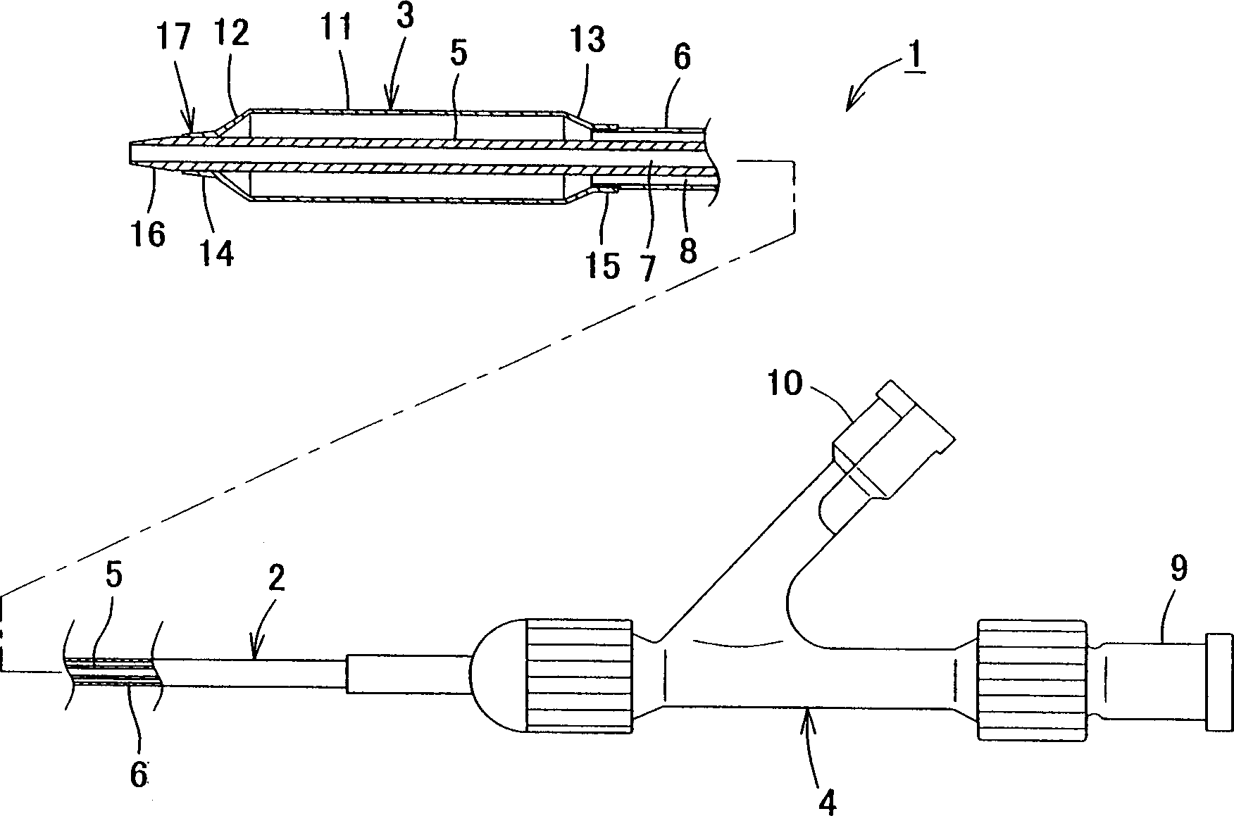 Balloon catheter