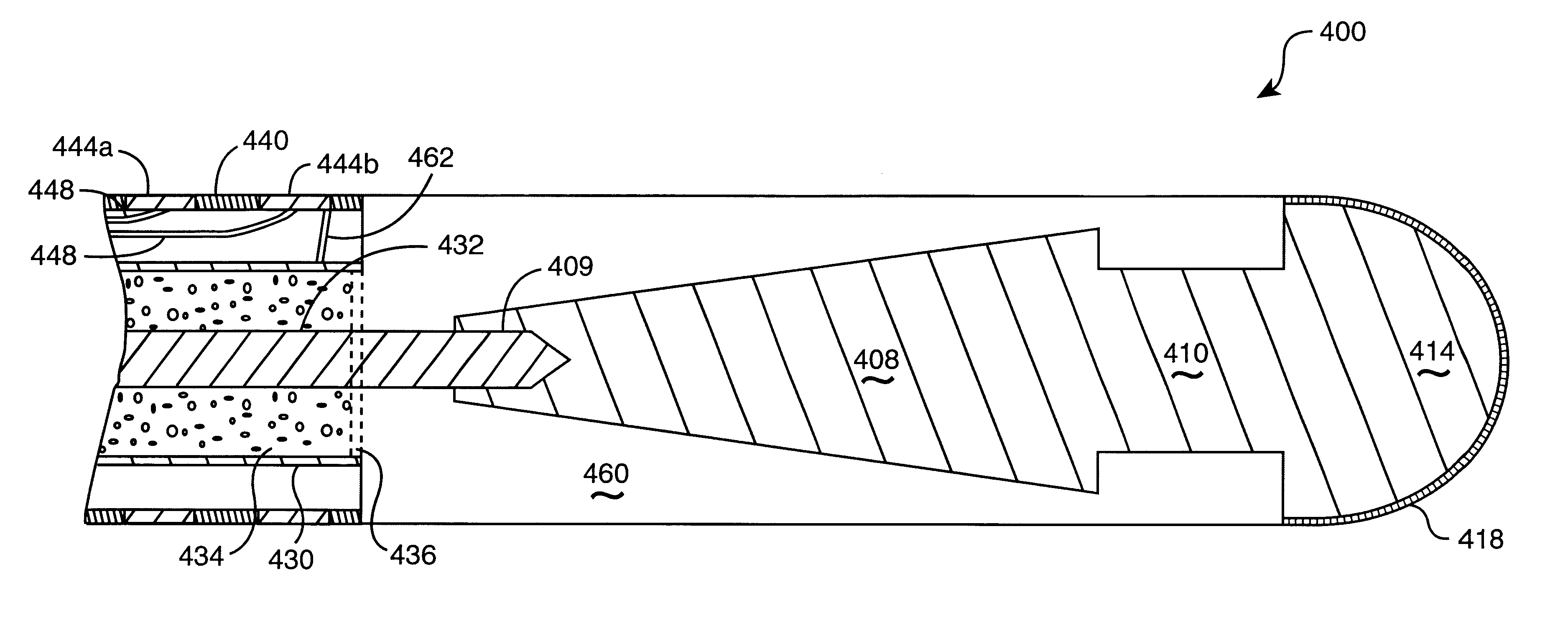 Monopole tip for ablation catheter and methods for using same