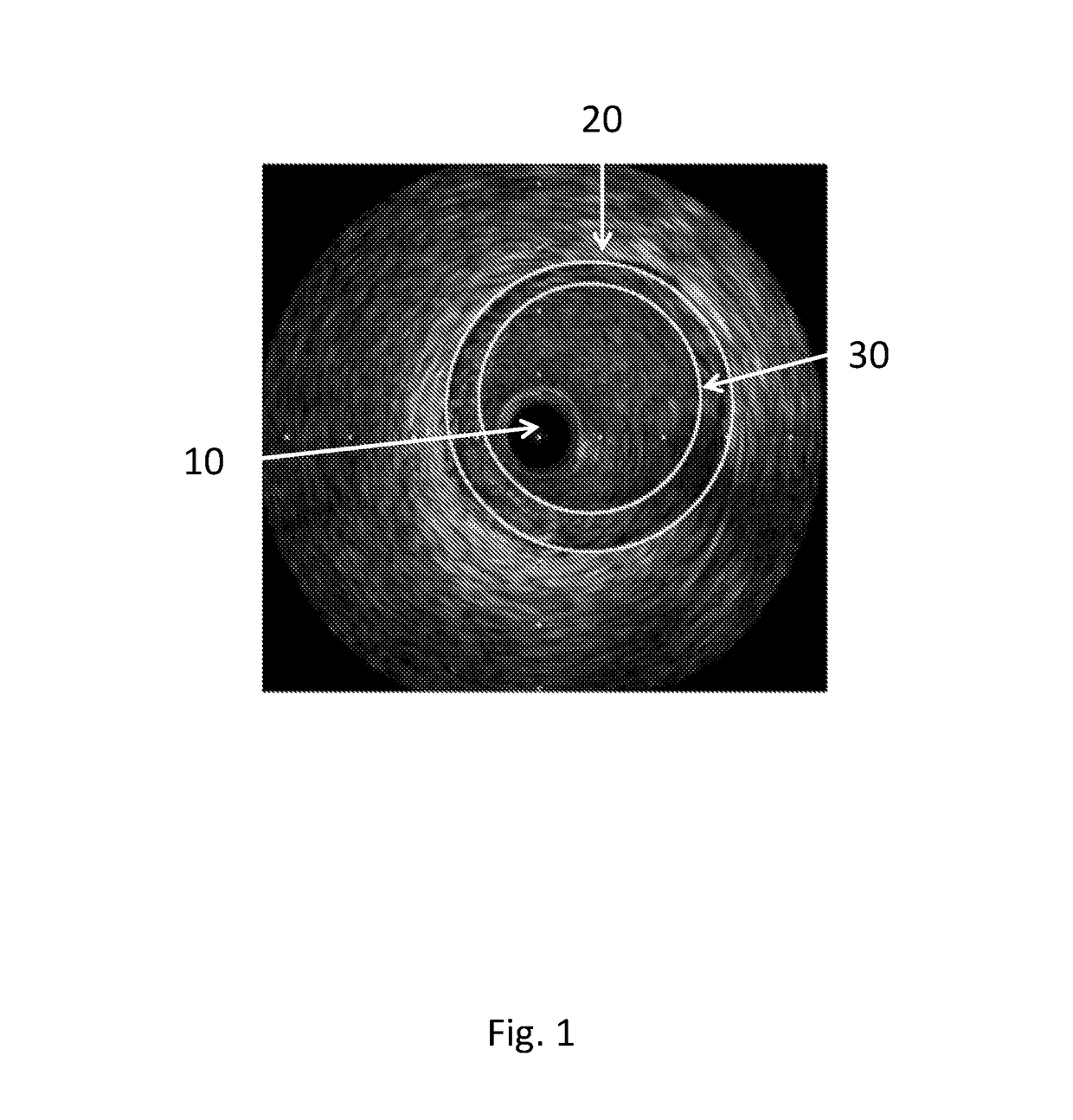 A method of mapping images of human disease and of designing or selecting a medical device using a surrogate model