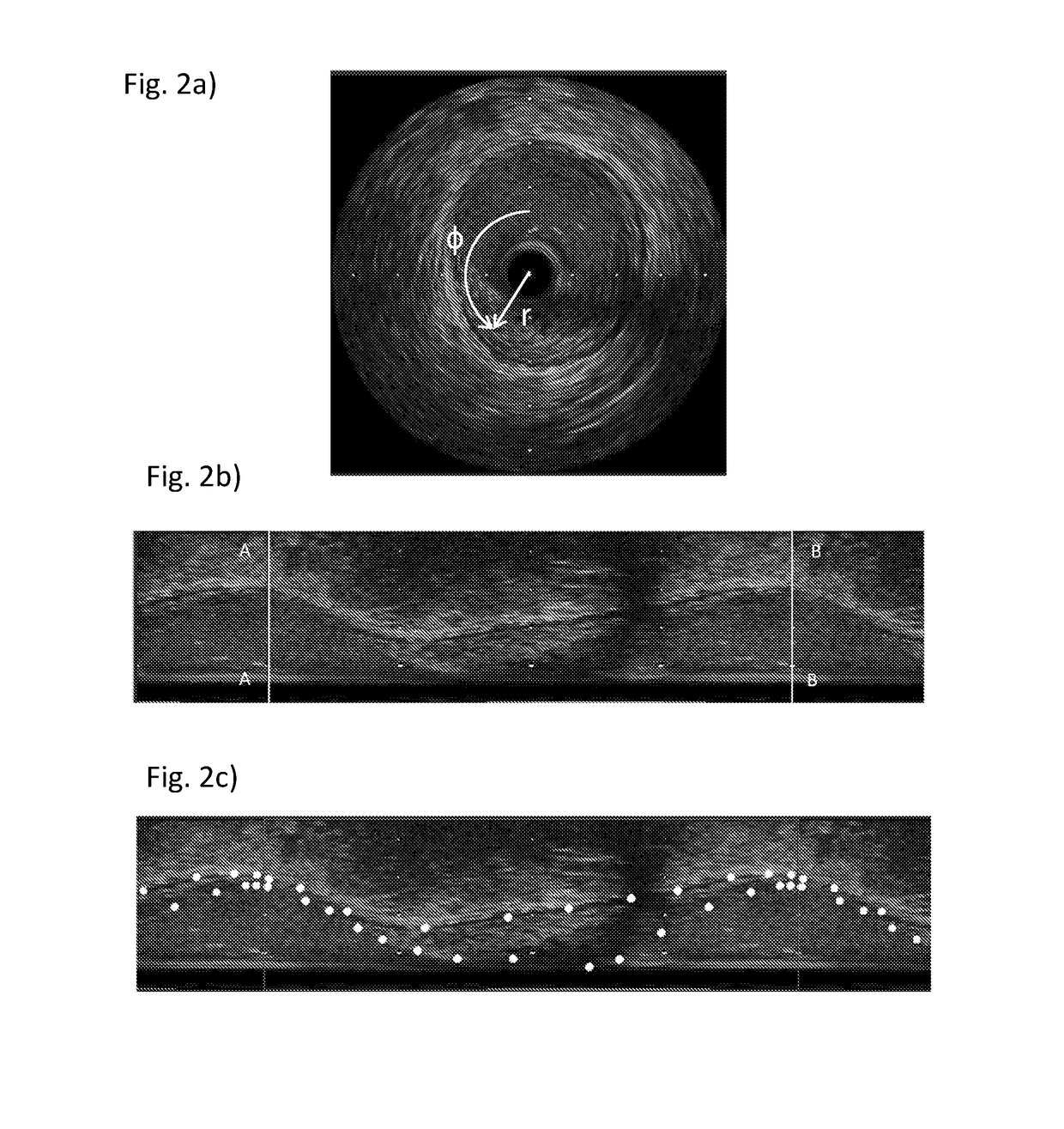 A method of mapping images of human disease and of designing or selecting a medical device using a surrogate model