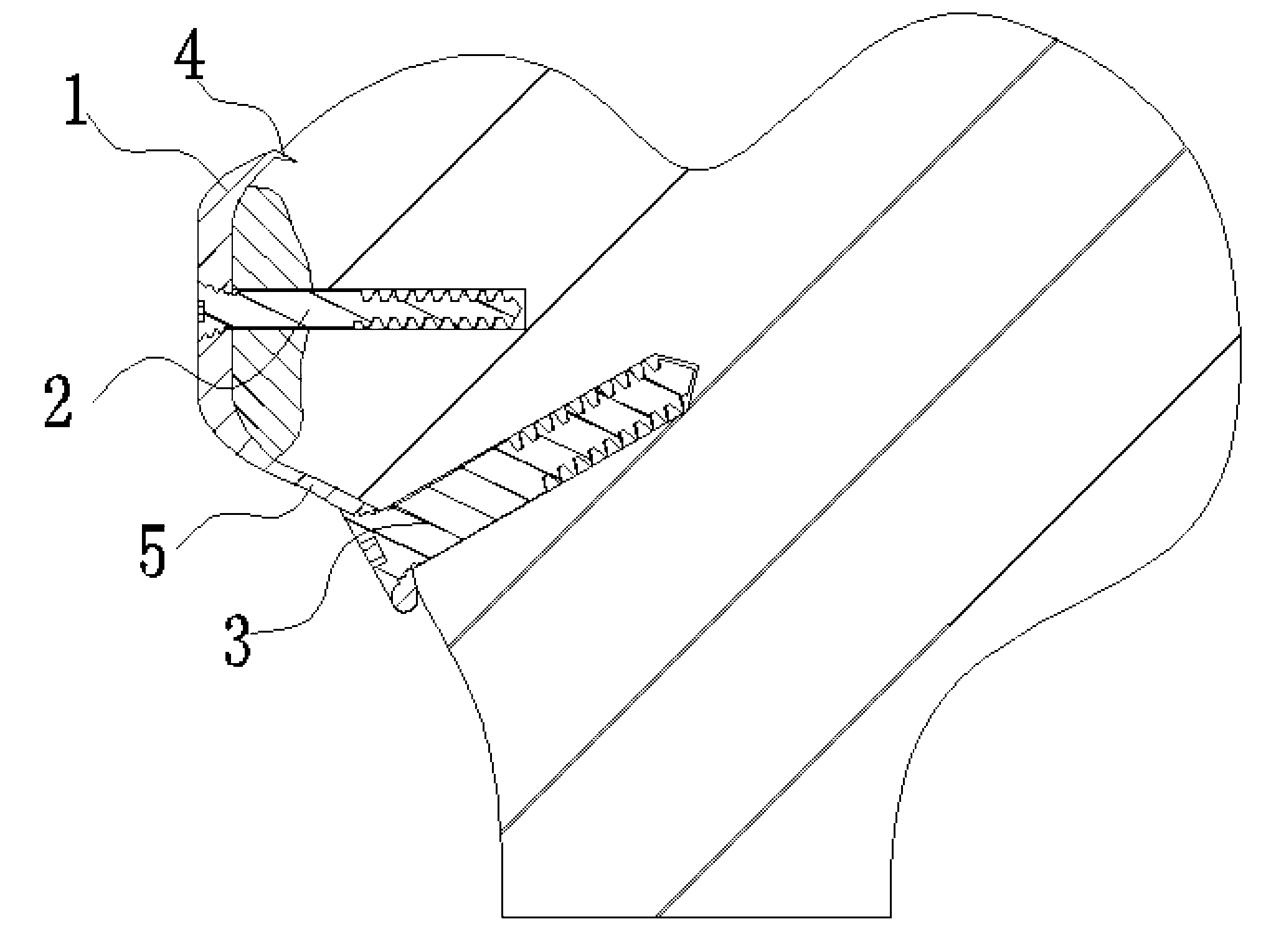 Novel toothed screw pad assembly for cure of avulsion fracture