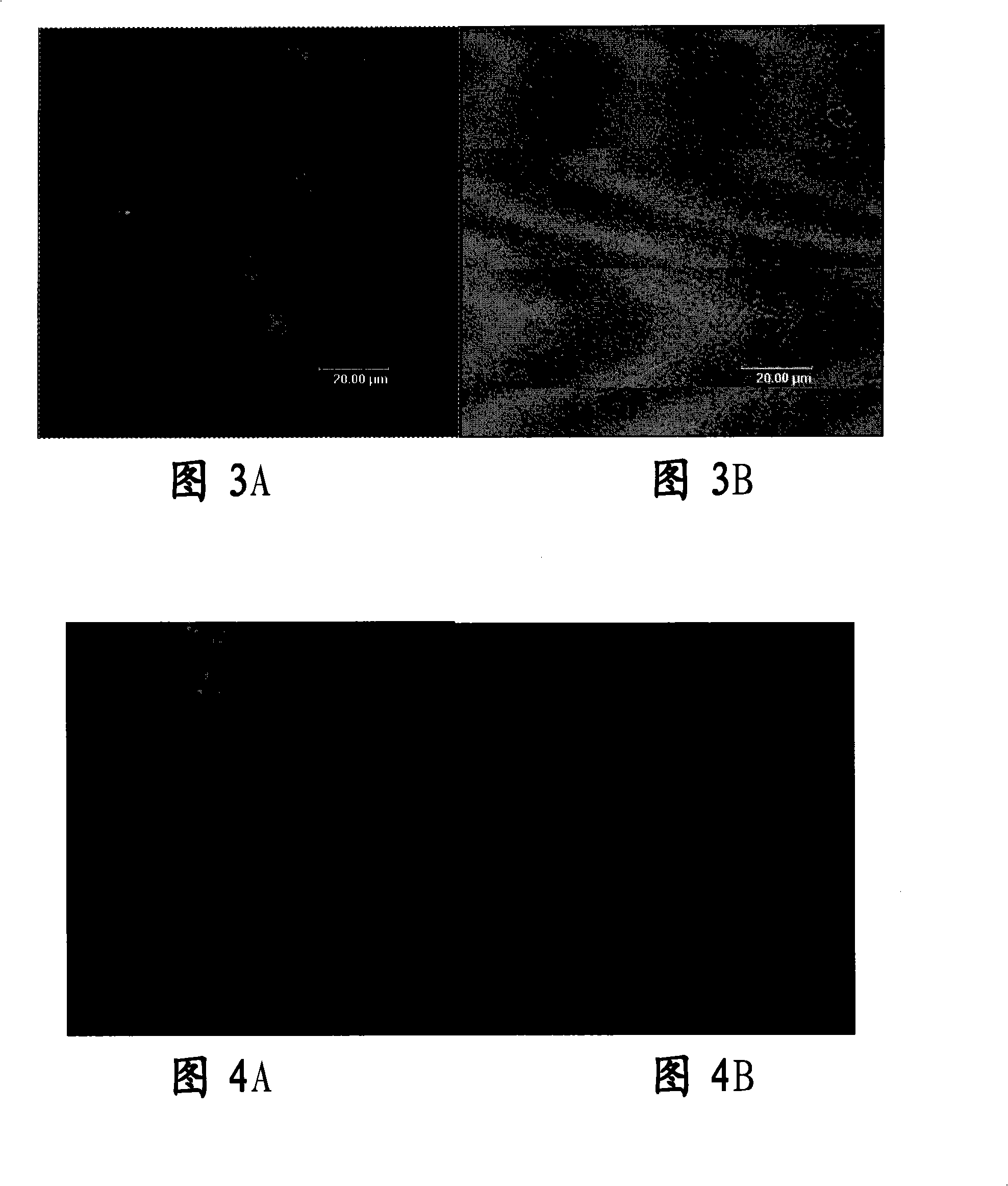 Tissue engineered cornea epithelial transplantation membrane and preparation method and use thereof