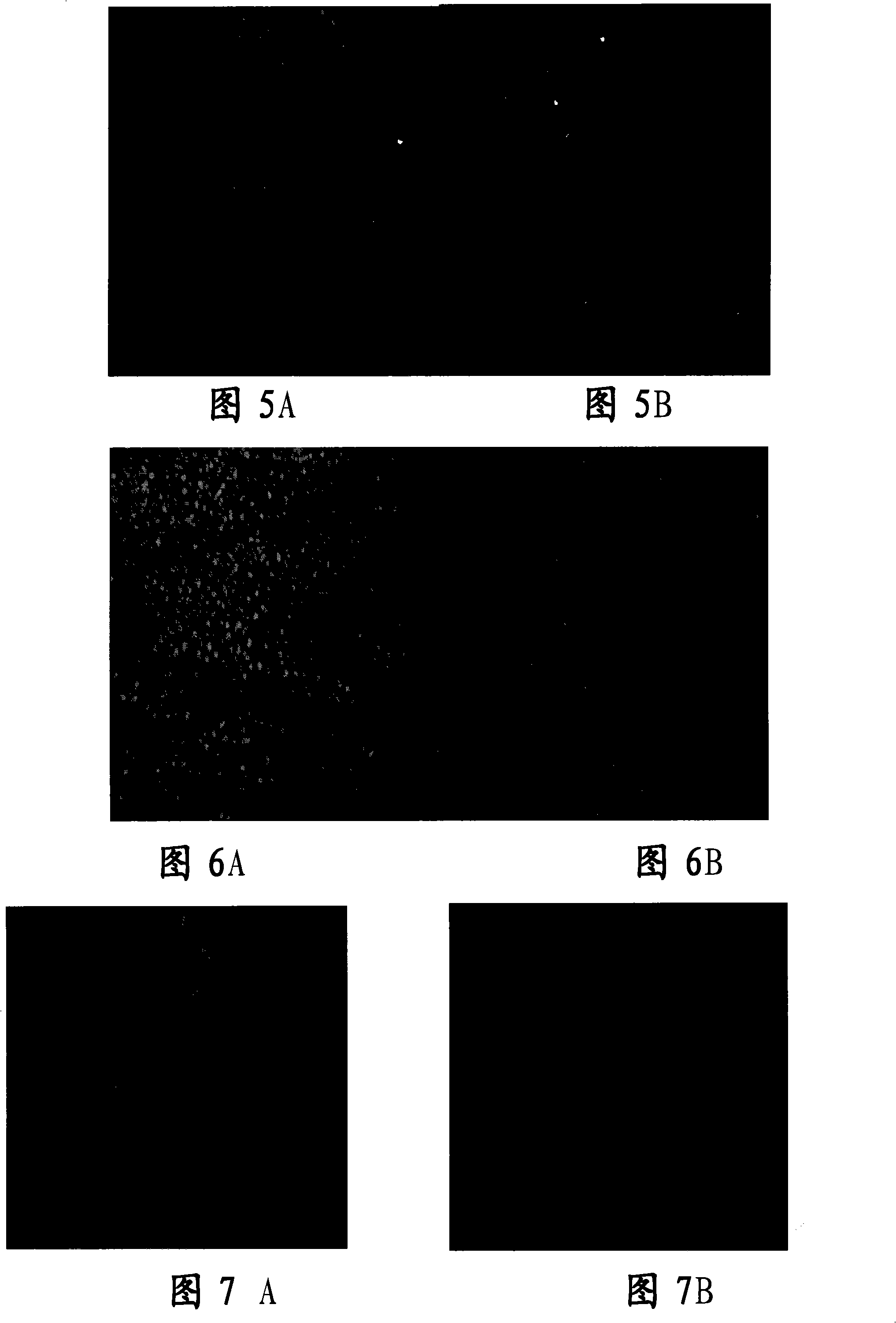 Tissue engineered cornea epithelial transplantation membrane and preparation method and use thereof