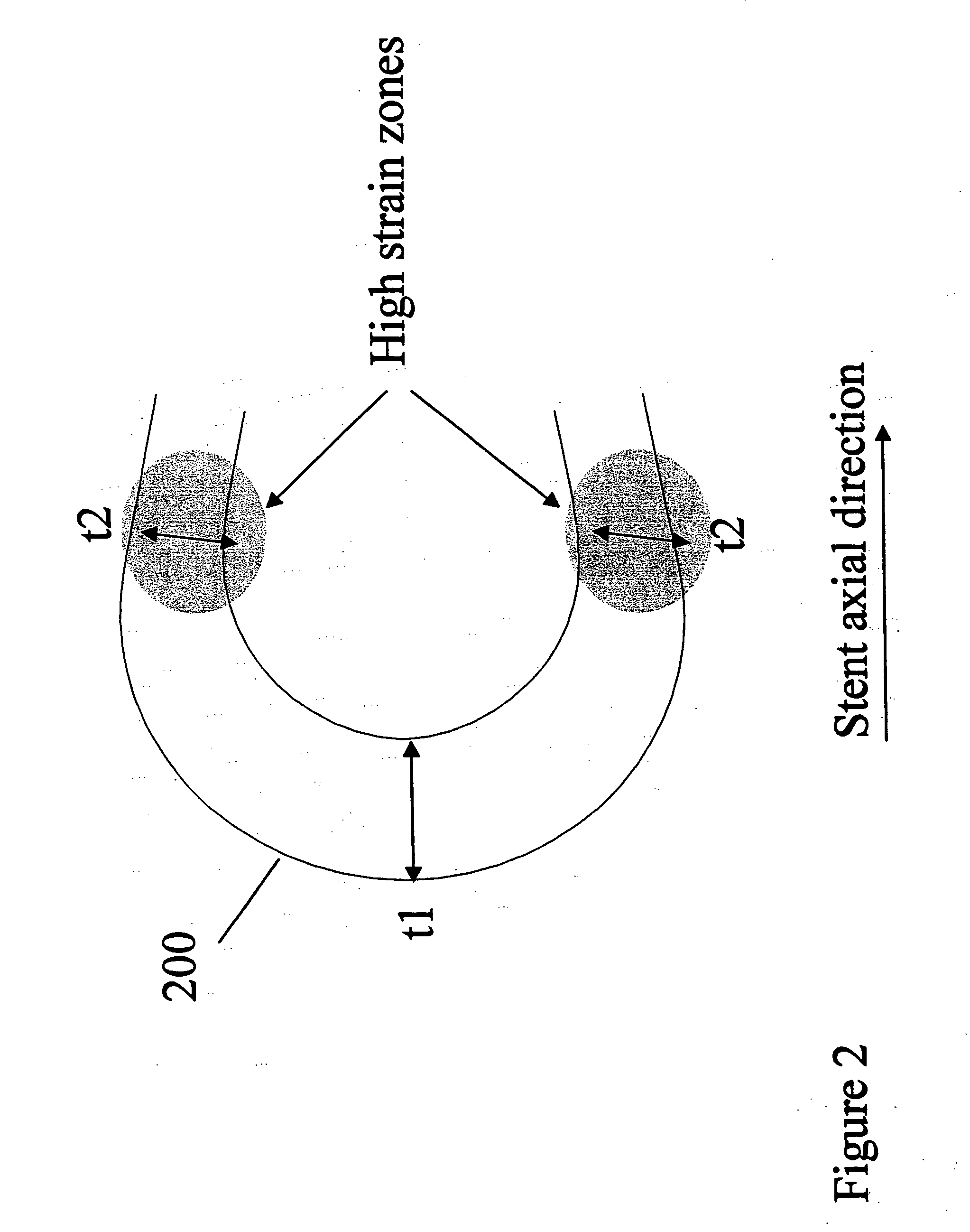 Polymeric stent having modified molecular structures in the flexible connectors and in the radial struts and the radial arcs of the hoops