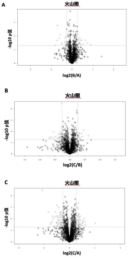 Iron metabolism-related protein marker composition and application thereof for risk prediction of high myopia and auxiliary diagnosis of high myopia