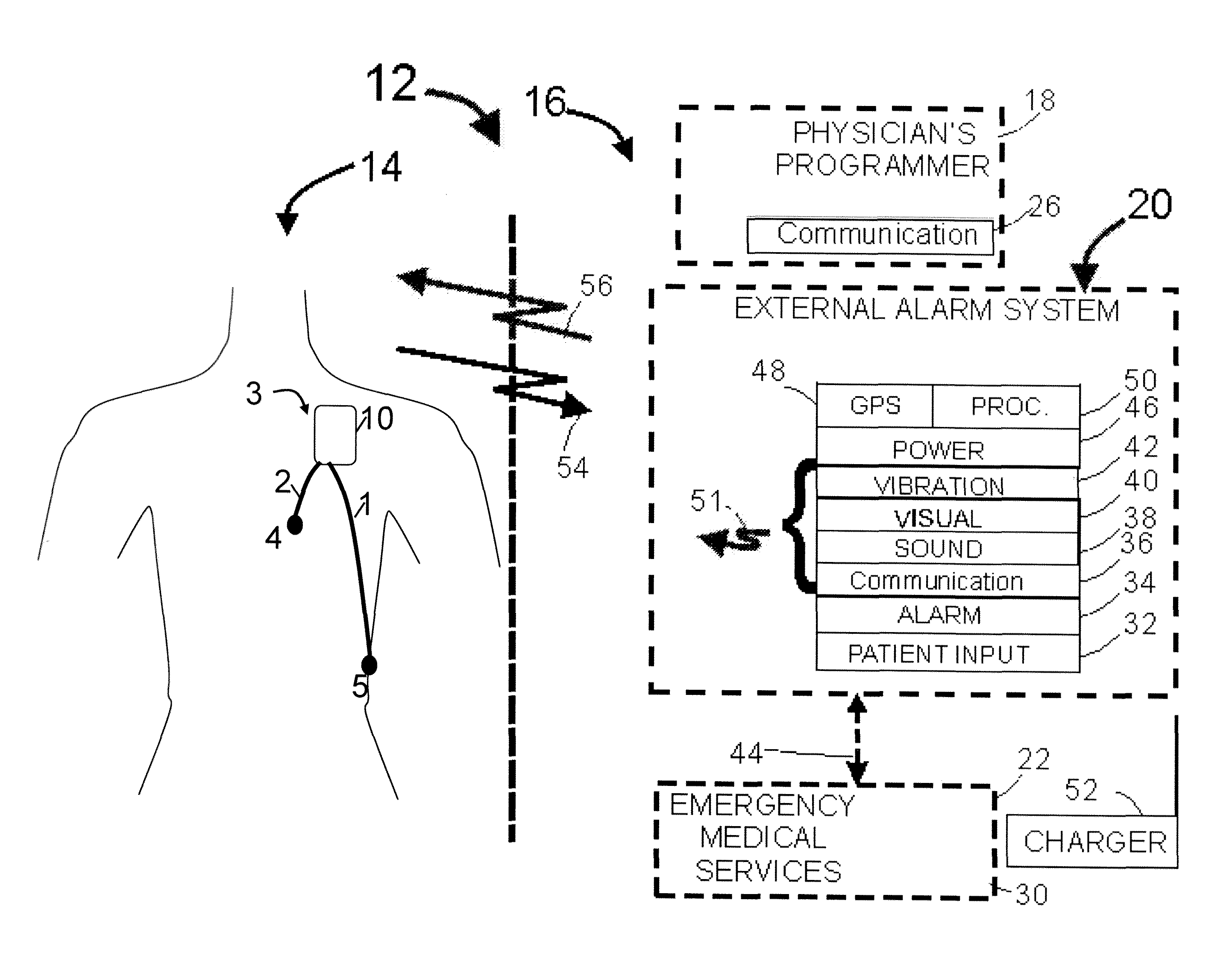 Parameter value rejection for a cardiac monitor