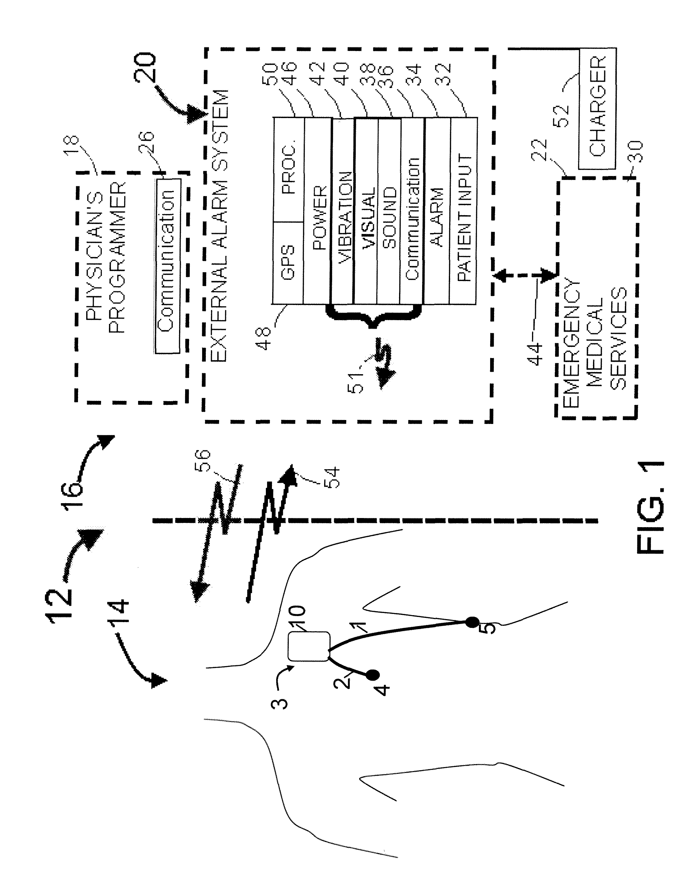 Parameter value rejection for a cardiac monitor