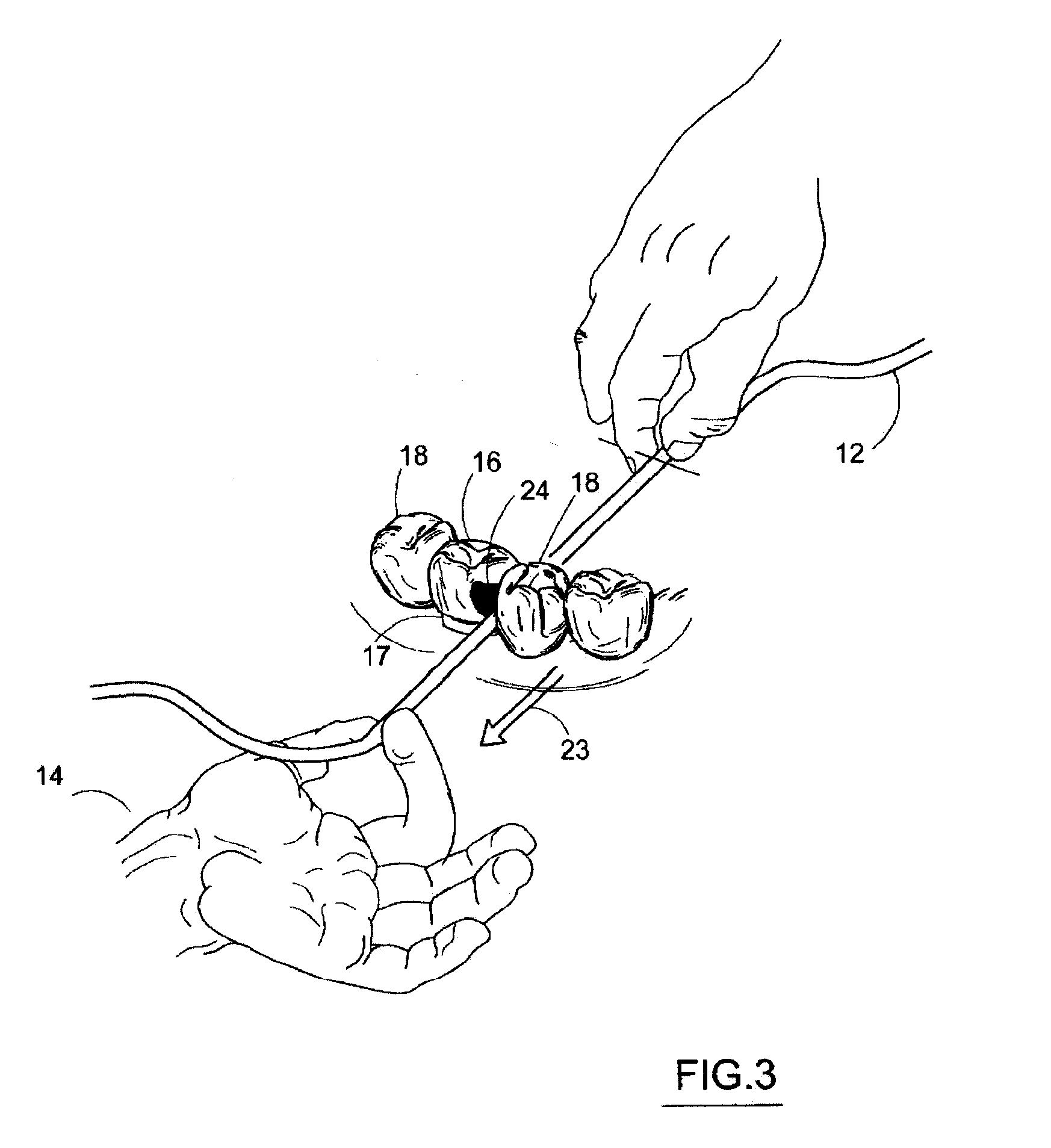 Method for seating a dental restoration