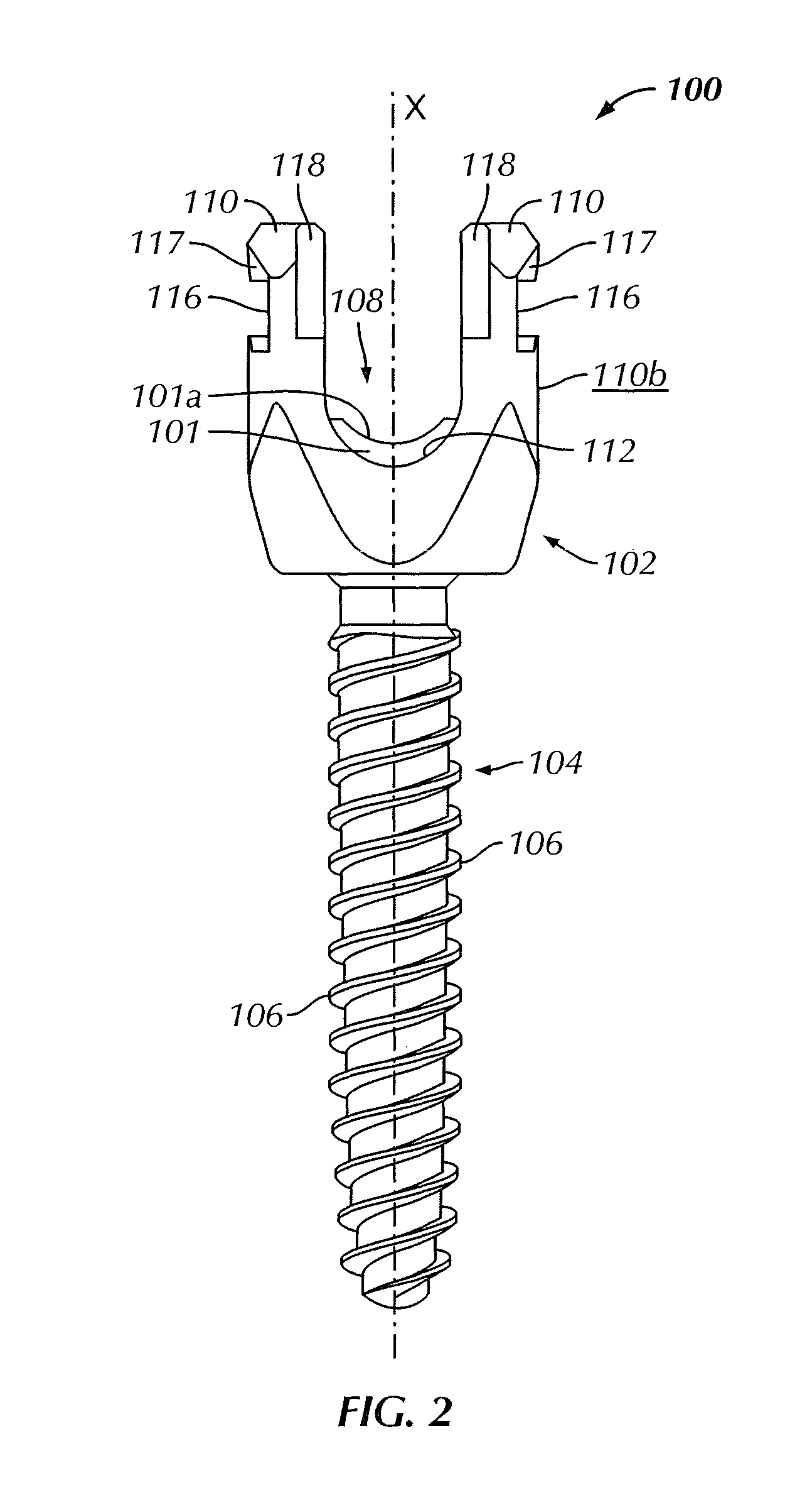 Minimally invasive instrument set, devices and related methods