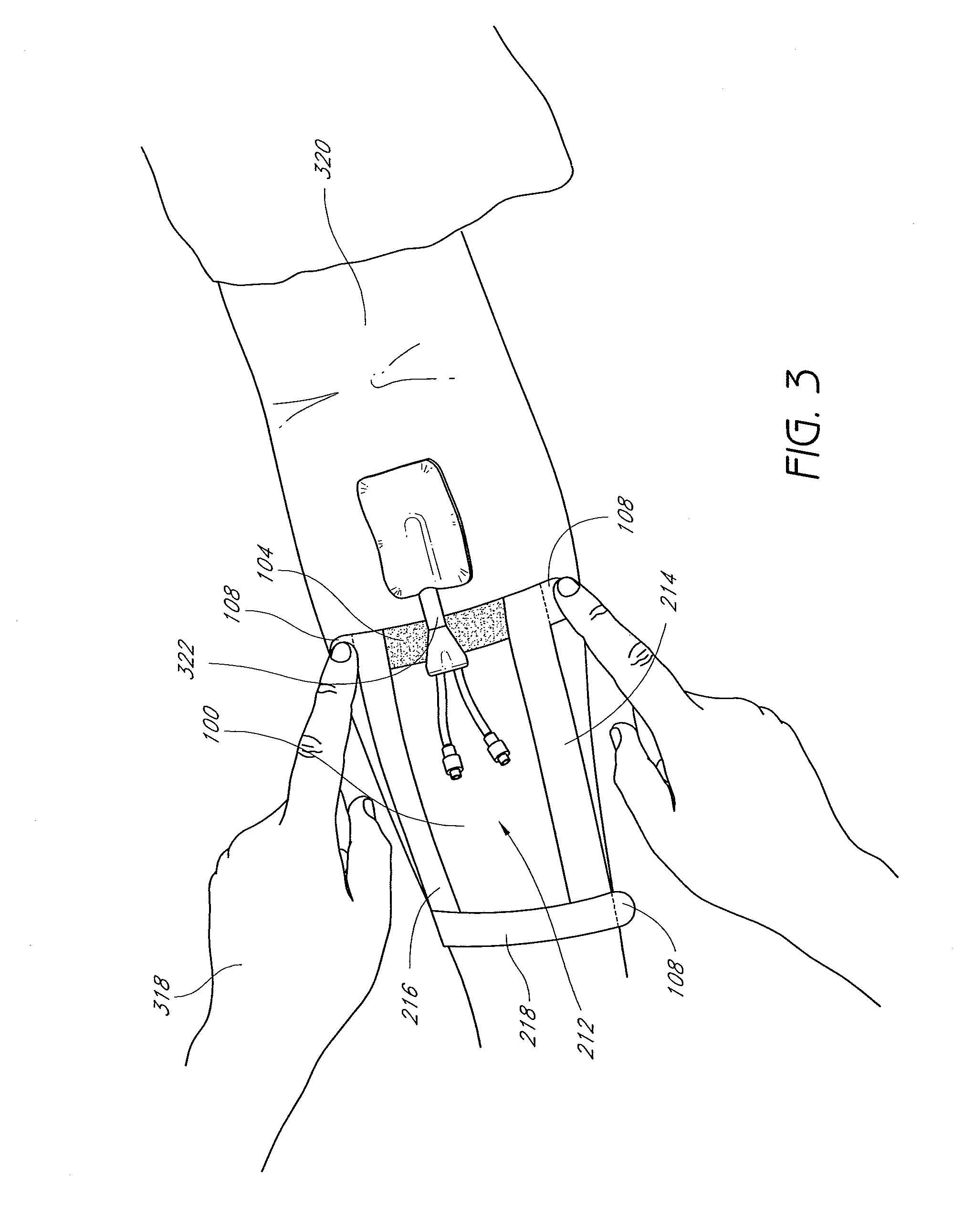 Flexible and leakproof and leak-resistant medical barriers and systems and methods of use thereof