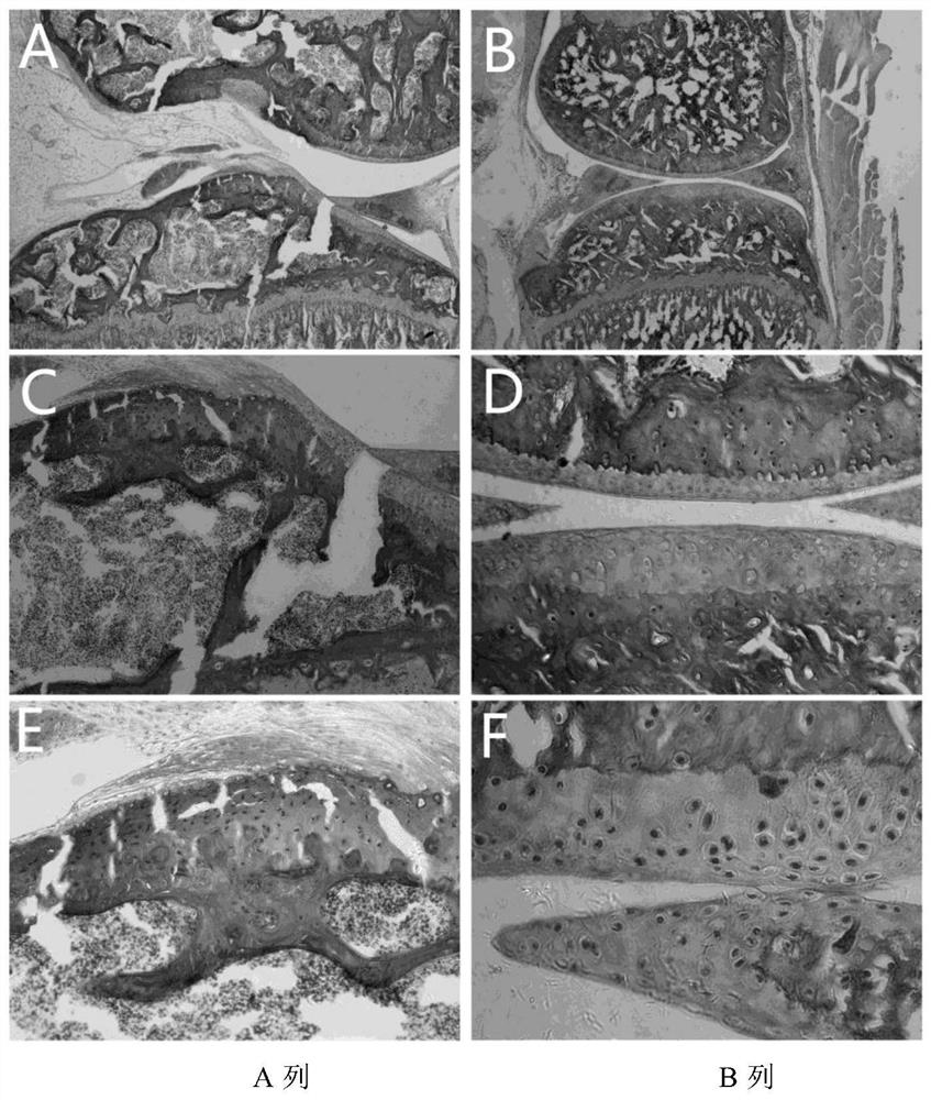 A method and device for displaying hard tissue pathological slices