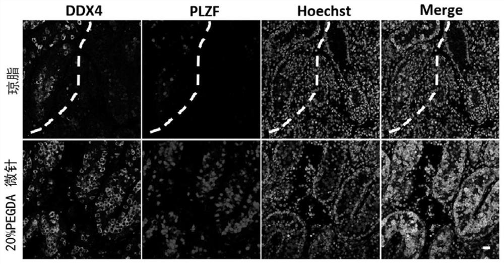 In vitro culture method and application of testicular tissue based on microneedles