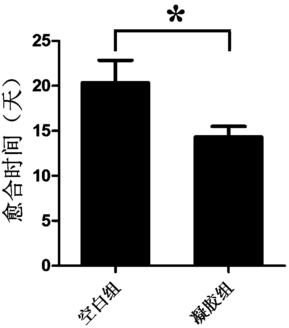 Method for preparing hydrogel wound dressing through low-temperature biological 3D printing technology