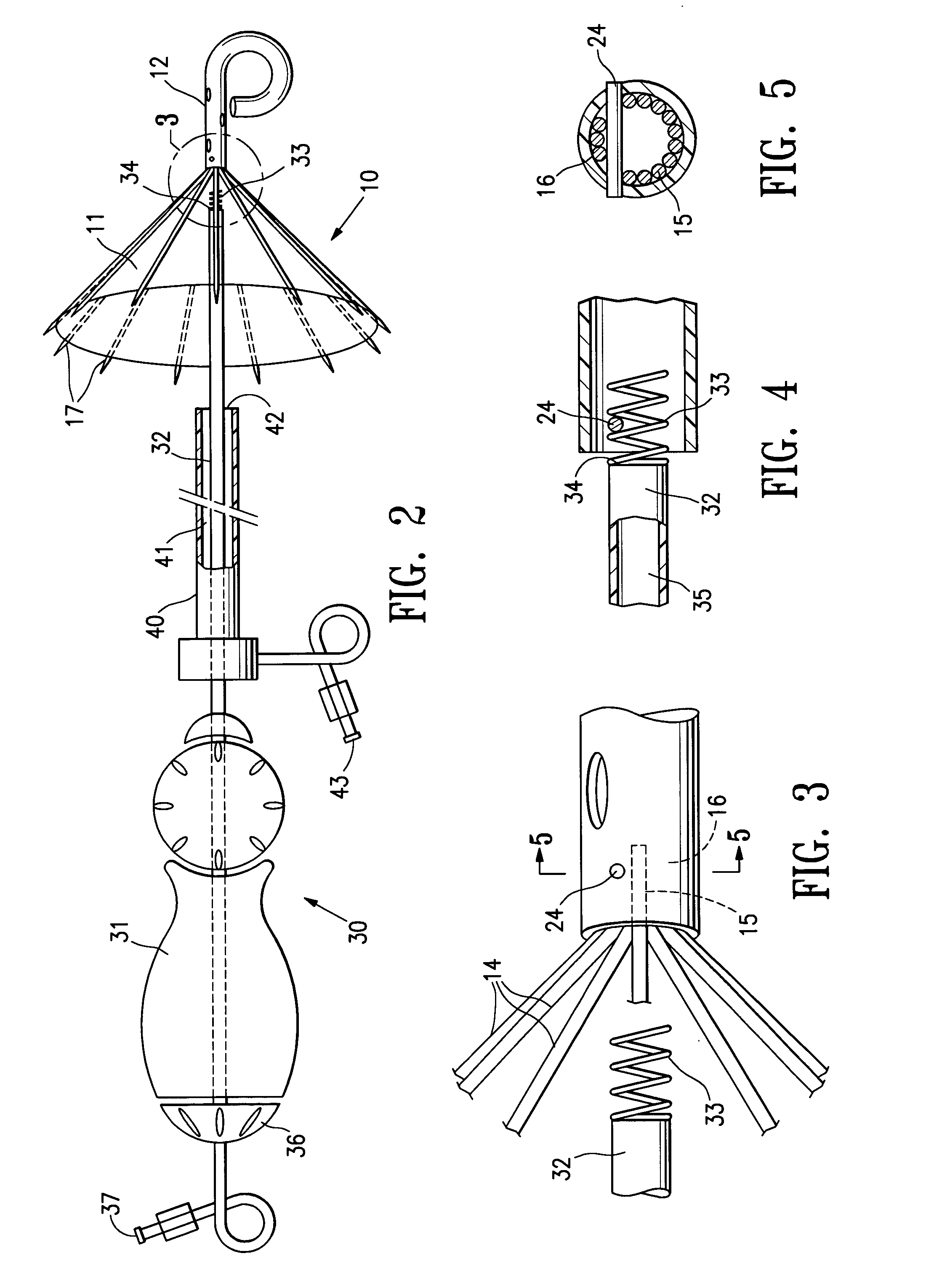 Ventricular partitioning device