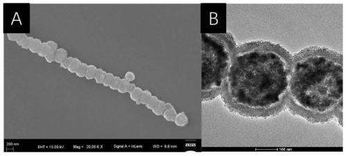 Rotatable magnetic nano chain supported palladium nanoparticle catalyst and preparation method thereof