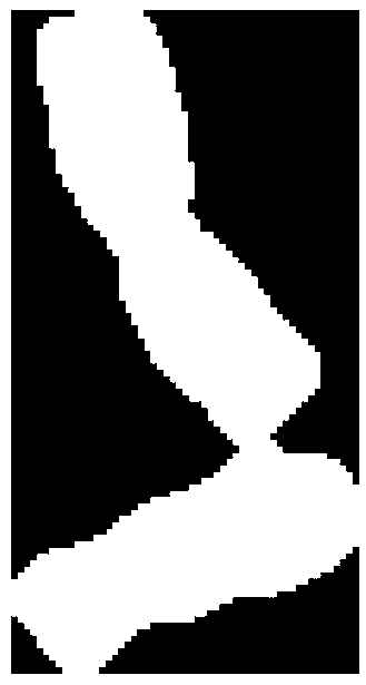 G-banded adherent chromosome segmentation method based on geometrical features and region fusion is proposed