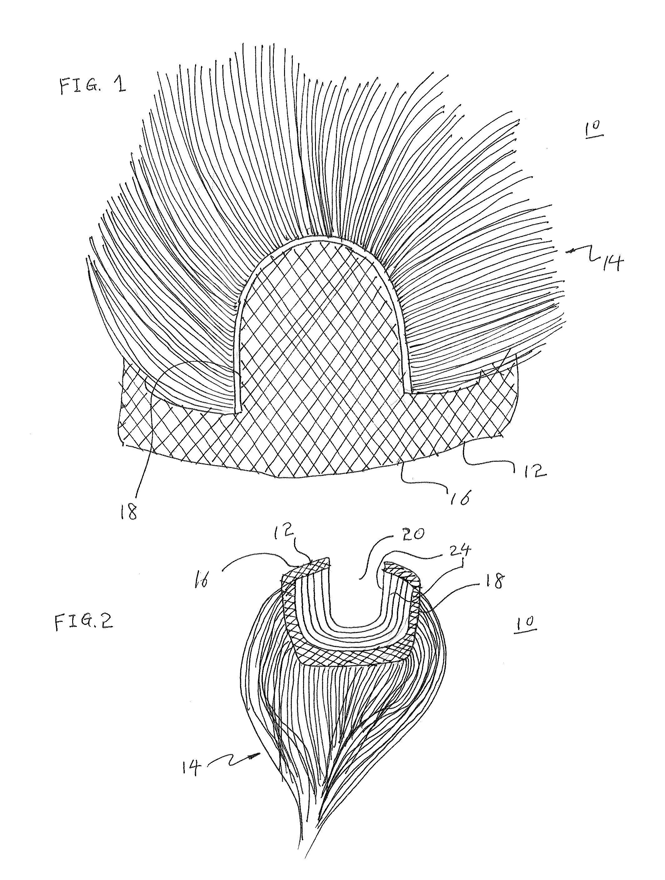 U-shaped Closure