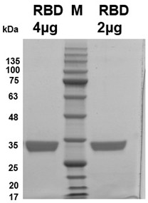 Novel coronavirus Brazilian strain p.  1 The gene of mutant rbd and its application