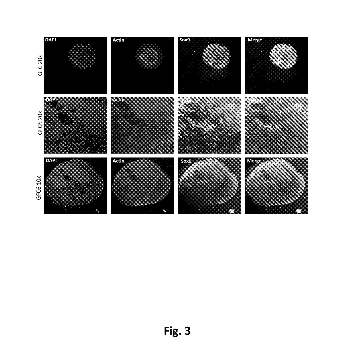 Methods for controlled proliferation of vestibular stem cells / generating inner ear hair cells using wnt and tgfbeta-inhibition